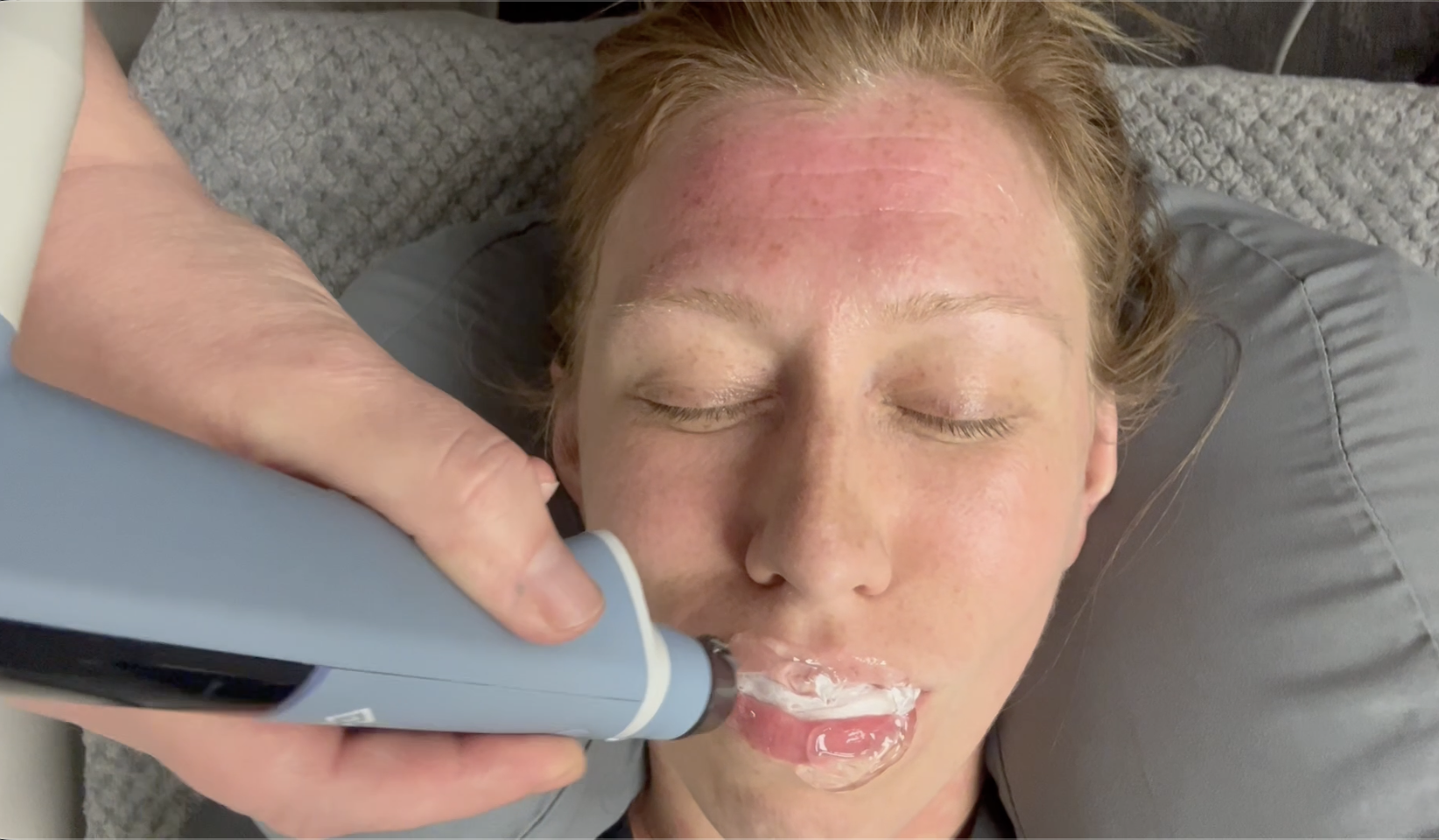 EXION Face & Body skin rejuvenation treatment